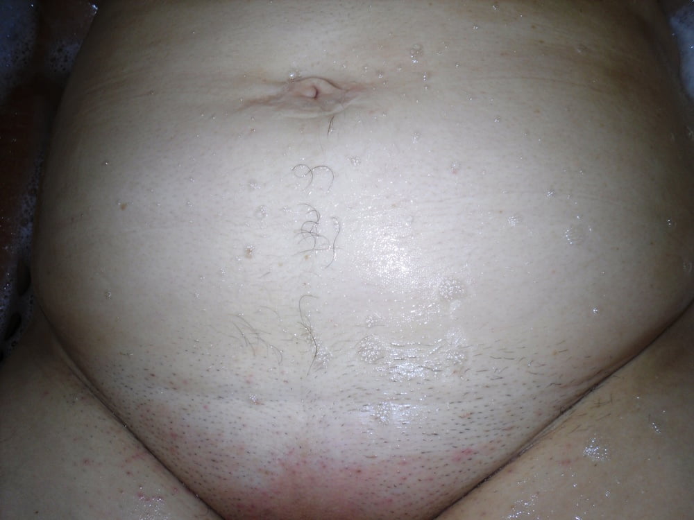 My Tummy Trail (1) #100579092