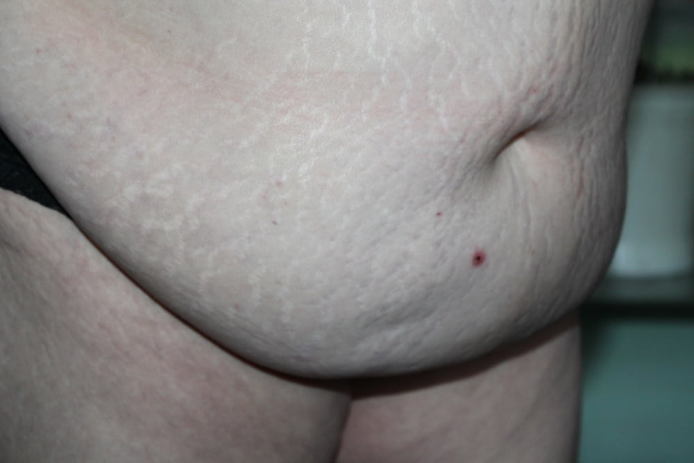 フェット
 #105485408