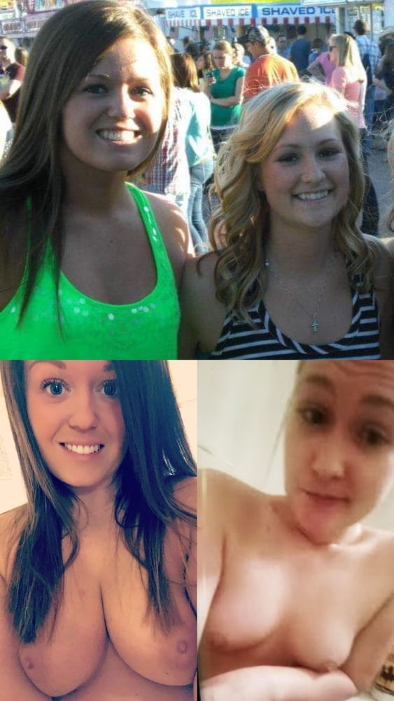 before and after #98915967