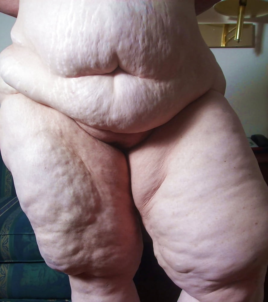 Sexy Cellulite and Stretchmarks #101130045