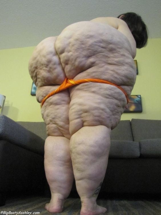 Sexy Cellulite and Stretchmarks #101130048