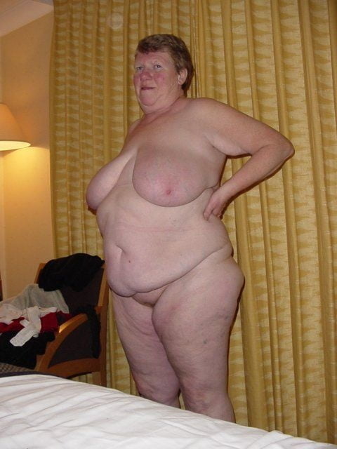 Sexy Cellulite and Stretchmarks #101130060