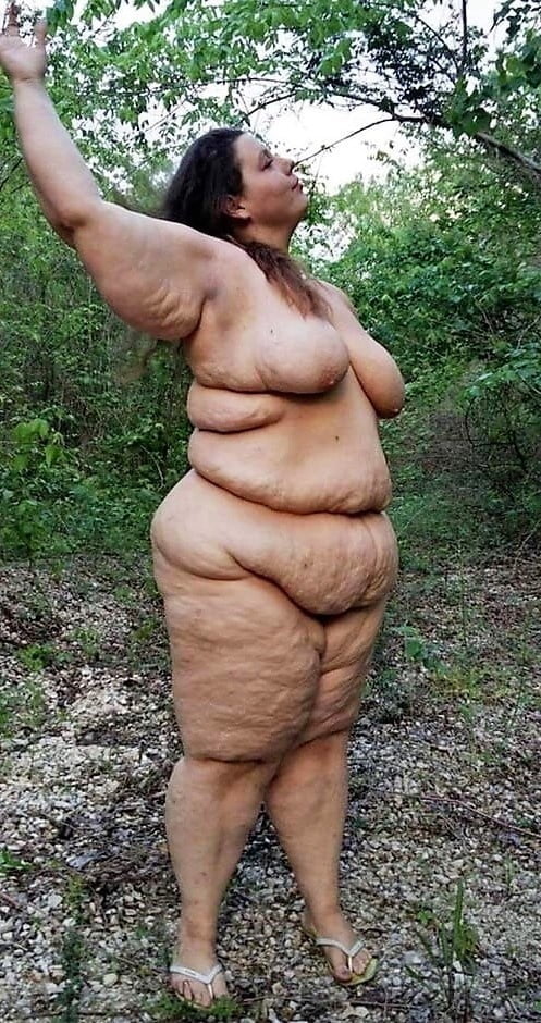 Sexy Cellulite and Stretchmarks #101130096