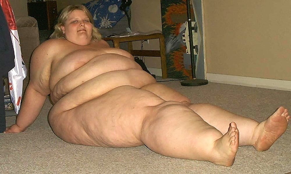 Sexy Cellulite and Stretchmarks #101130100