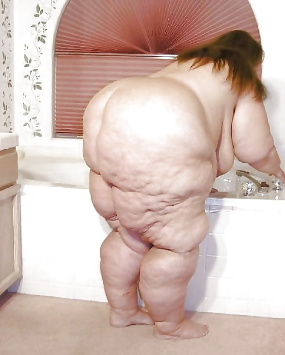 Sexy Cellulite and Stretchmarks #101130111