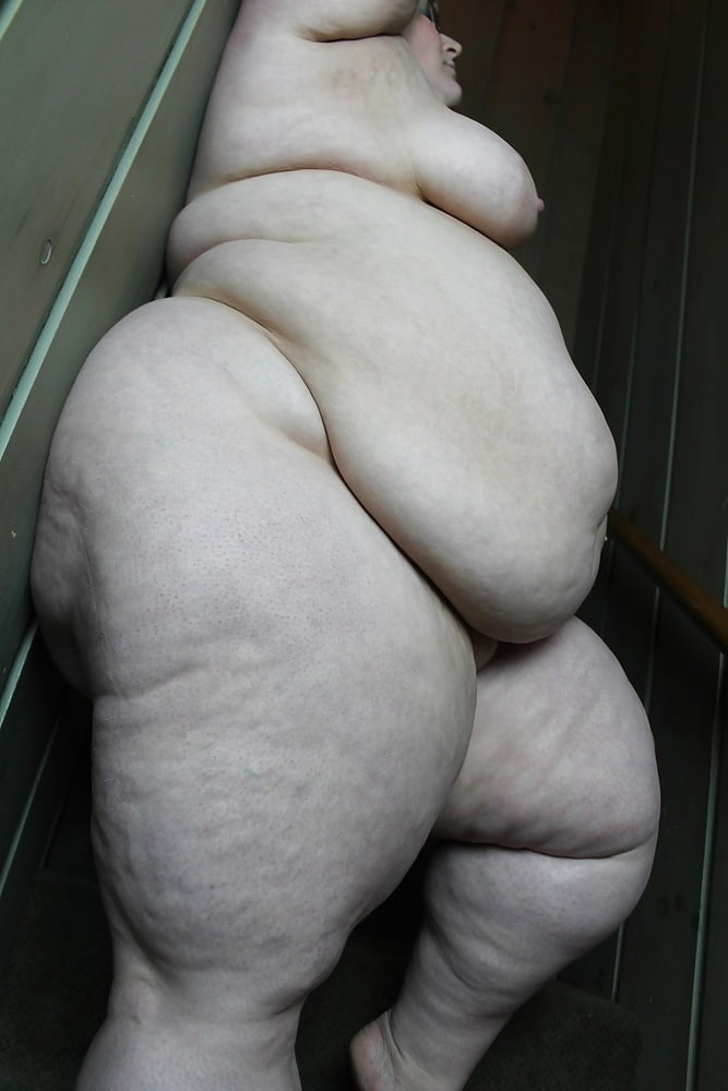 Sexy Cellulite and Stretchmarks #101130114