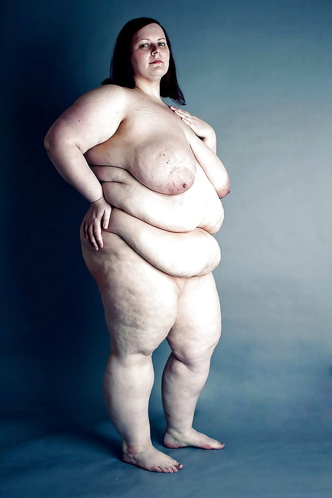 Sexy Cellulite and Stretchmarks #101130117
