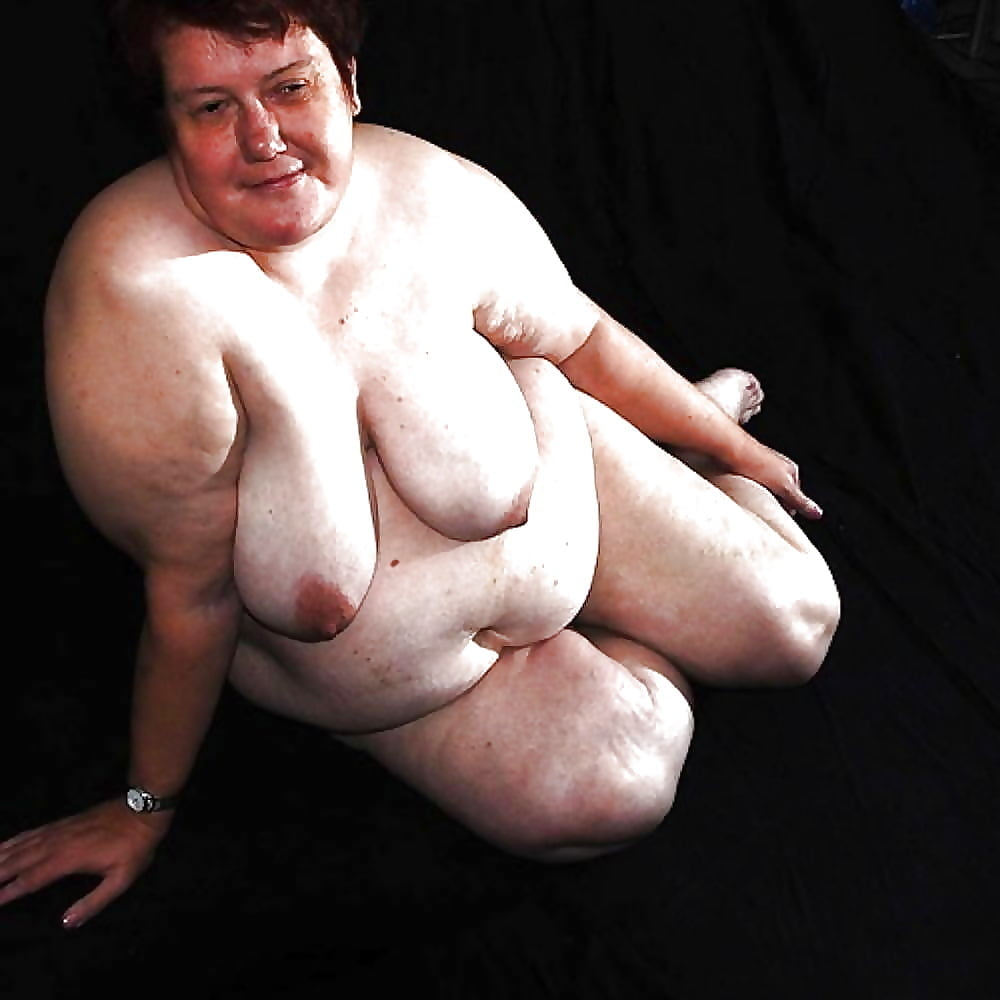 Sexy Cellulite and Stretchmarks #101130122