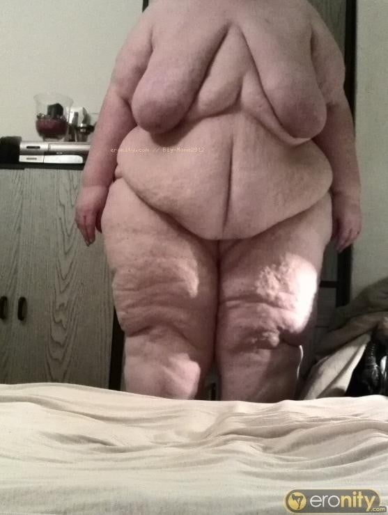 Sexy Cellulite and Stretchmarks #101130130