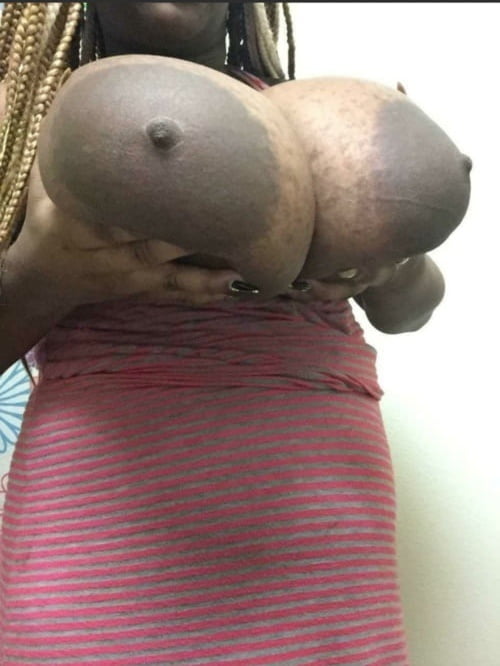 BIG LARGE AREOLAS #101428803