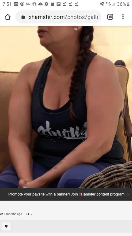 Cellulite Schlampen 2 . sehr fette Arme, schlaffer Arsch, Cellulite Bein
 #87508408