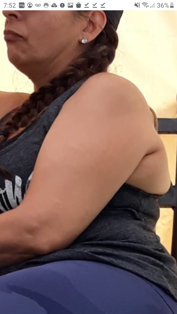 Cellulite Schlampen 2 . sehr fette Arme, schlaffer Arsch, Cellulite Bein
 #87508410