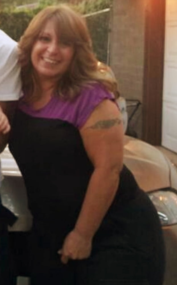 Cellulite Schlampen 2 . sehr fette Arme, schlaffer Arsch, Cellulite Bein
 #87508412