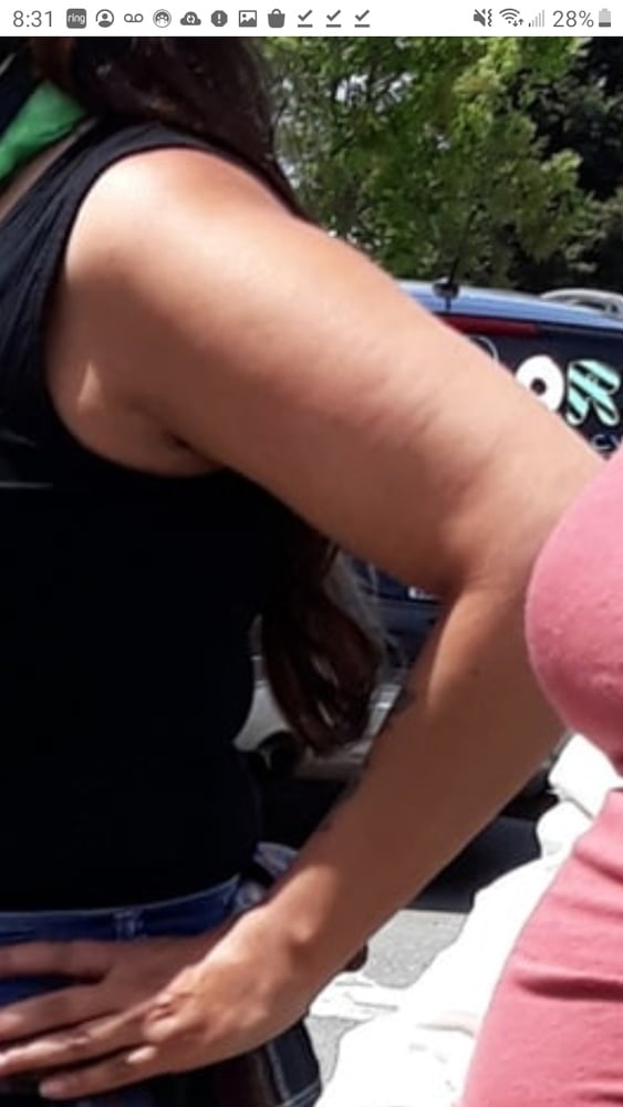 Cellulite Schlampen 2 . sehr fette Arme, schlaffer Arsch, Cellulite Bein
 #87508416