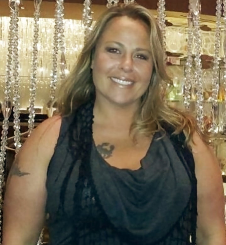 Cellulite Schlampen 2 . sehr fette Arme, schlaffer Arsch, Cellulite Bein
 #87508418