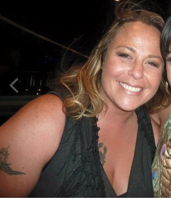 Cellulite Schlampen 2 . sehr fette Arme, schlaffer Arsch, Cellulite Bein
 #87508424