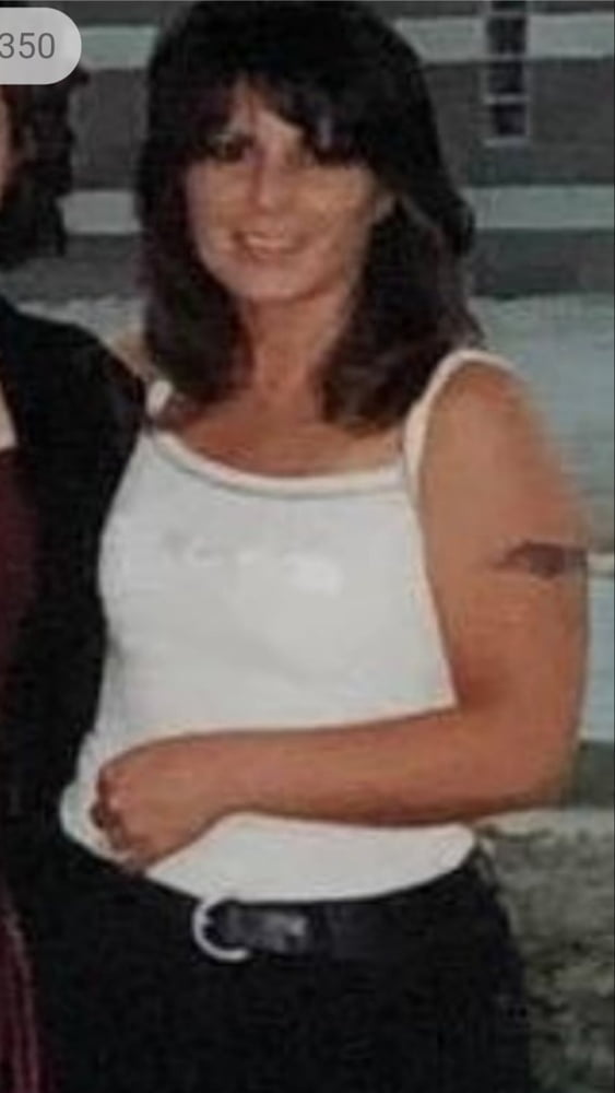 Cellulite Schlampen 2 . sehr fette Arme, schlaffer Arsch, Cellulite Bein
 #87508426