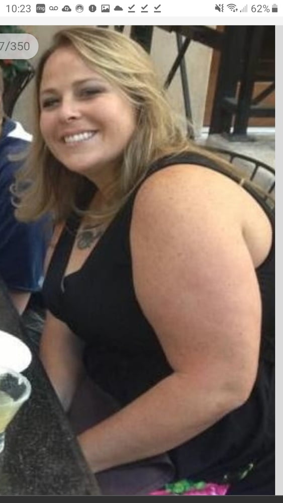 Cellulite Schlampen 2 . sehr fette Arme, schlaffer Arsch, Cellulite Bein
 #87508428