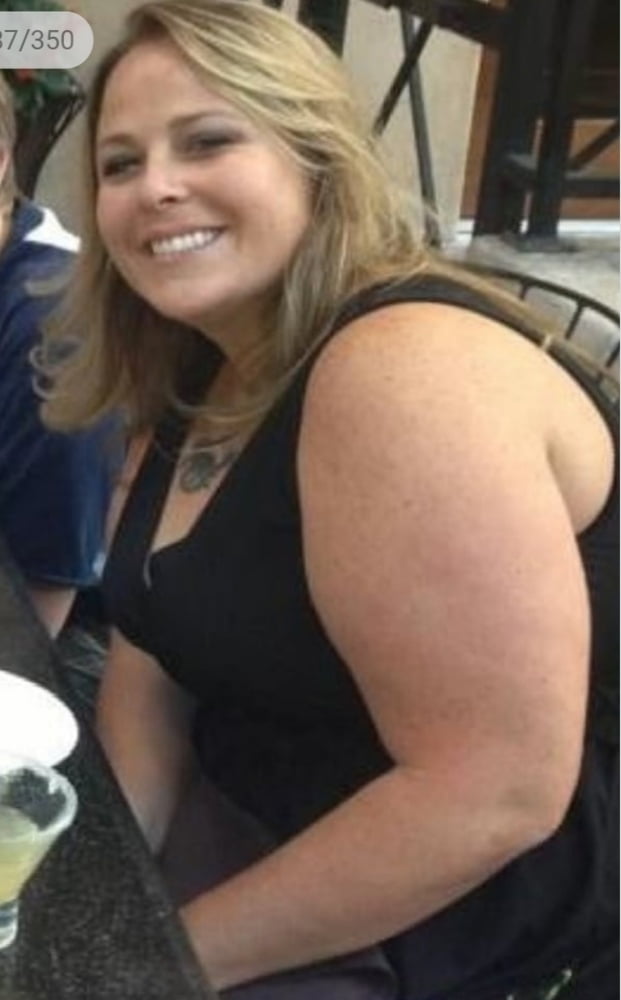 Cellulite Schlampen 2 . sehr fette Arme, schlaffer Arsch, Cellulite Bein
 #87508430