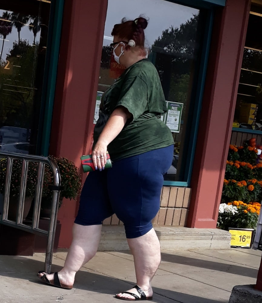 Cellulite Schlampen 2 . sehr fette Arme, schlaffer Arsch, Cellulite Bein
 #87508433