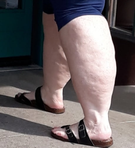 Cellulite Schlampen 2 . sehr fette Arme, schlaffer Arsch, Cellulite Bein
 #87508452