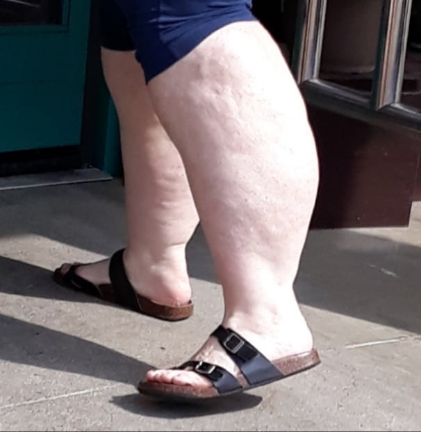 Cellulite Schlampen 2 . sehr fette Arme, schlaffer Arsch, Cellulite Bein
 #87508458