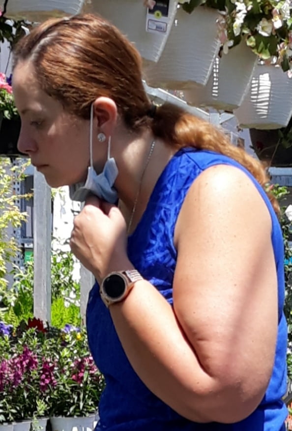 Cellulite Schlampen 2 . sehr fette Arme, schlaffer Arsch, Cellulite Bein
 #87508516