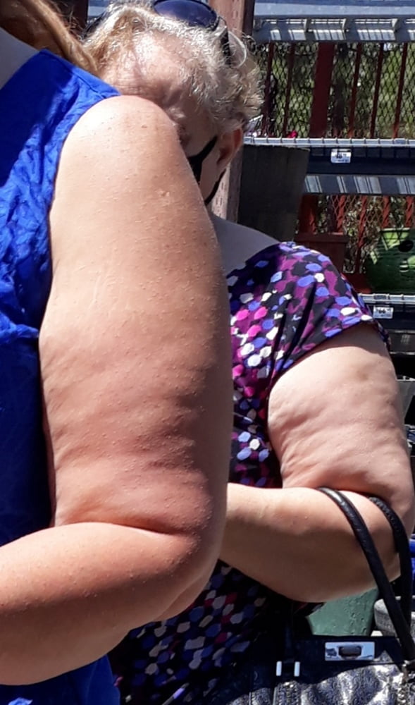 Cellulite Schlampen 2 . sehr fette Arme, schlaffer Arsch, Cellulite Bein
 #87508525