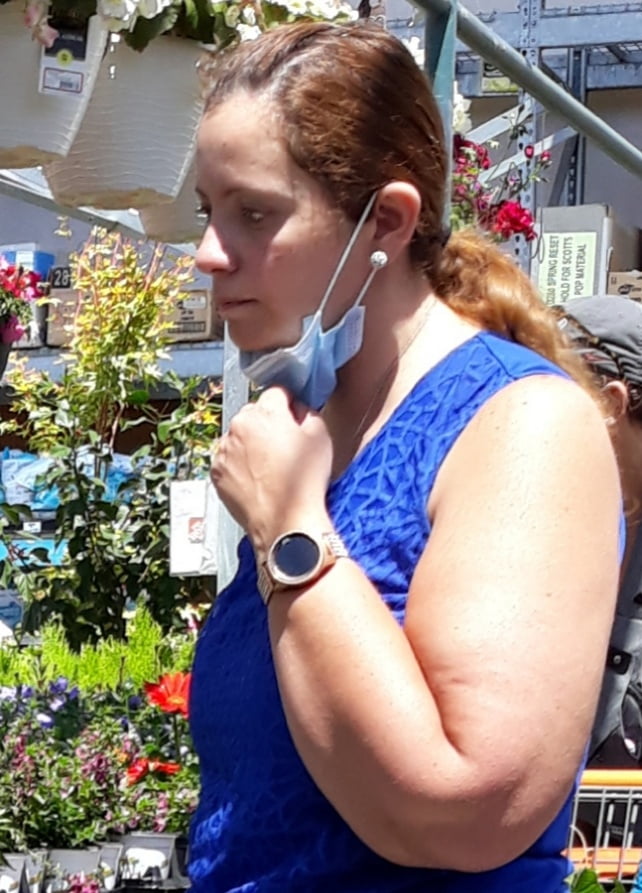 Cellulite Schlampen 2 . sehr fette Arme, schlaffer Arsch, Cellulite Bein
 #87508527