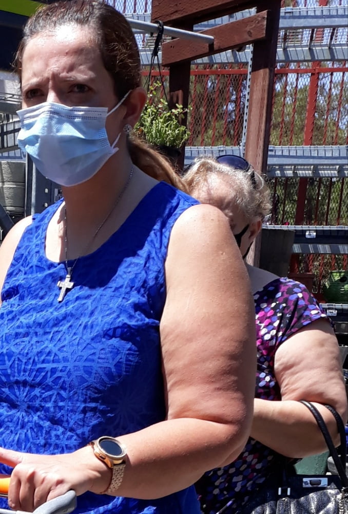 Cellulite Schlampen 2 . sehr fette Arme, schlaffer Arsch, Cellulite Bein
 #87508529