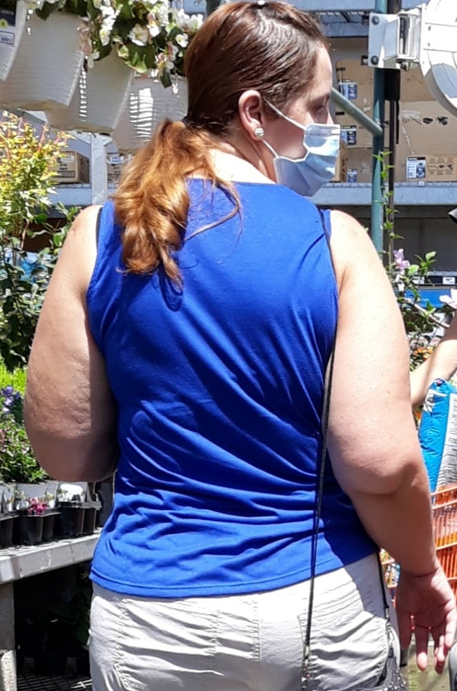 Cellulite Schlampen 2 . sehr fette Arme, schlaffer Arsch, Cellulite Bein
 #87508531