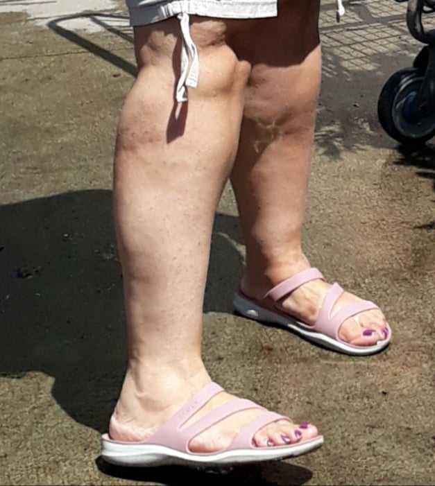 Cellulite Schlampen 2 . sehr fette Arme, schlaffer Arsch, Cellulite Bein
 #87508537