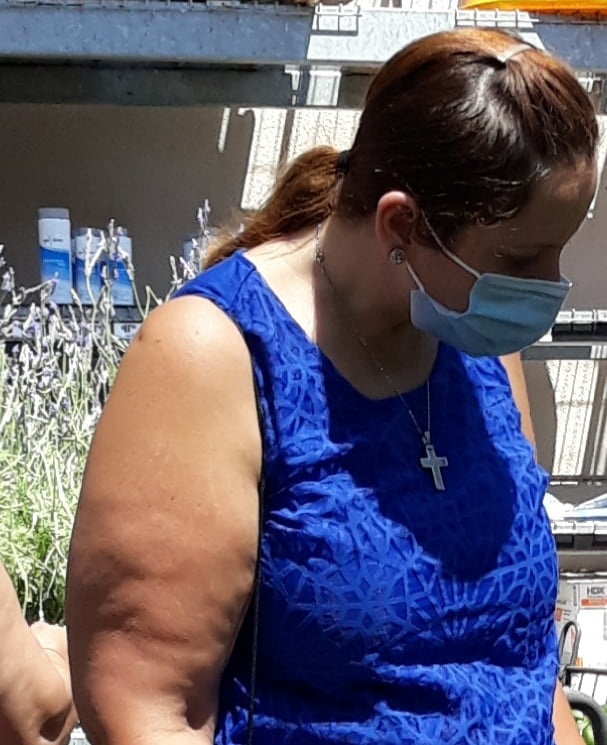 Cellulite Schlampen 2 . sehr fette Arme, schlaffer Arsch, Cellulite Bein
 #87508541