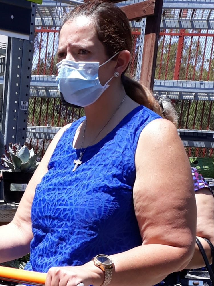 Cellulite Schlampen 2 . sehr fette Arme, schlaffer Arsch, Cellulite Bein
 #87508548