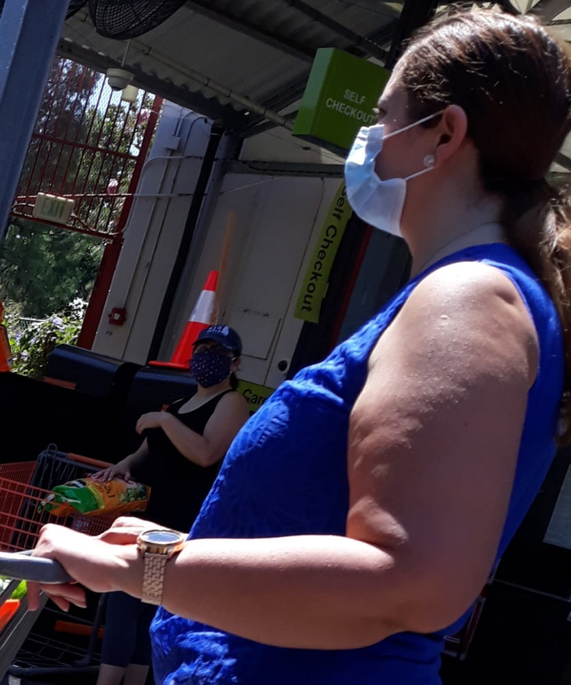 Cellulite Schlampen 2 . sehr fette Arme, schlaffer Arsch, Cellulite Bein
 #87508553