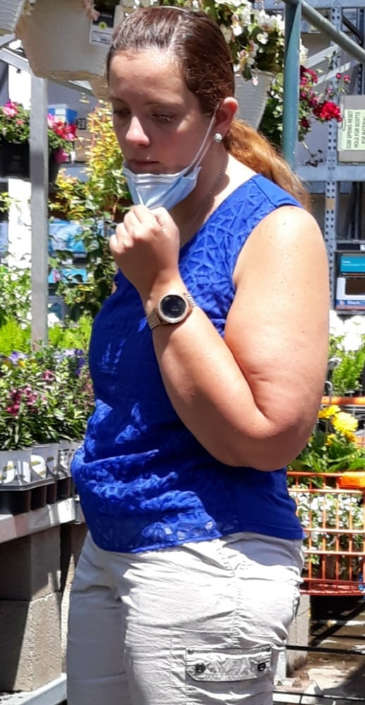 Cellulite Schlampen 2 . sehr fette Arme, schlaffer Arsch, Cellulite Bein
 #87508559