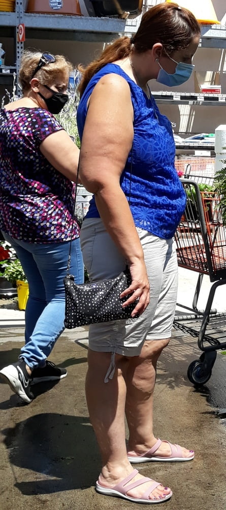 Cellulite Schlampen 2 . sehr fette Arme, schlaffer Arsch, Cellulite Bein
 #87508571