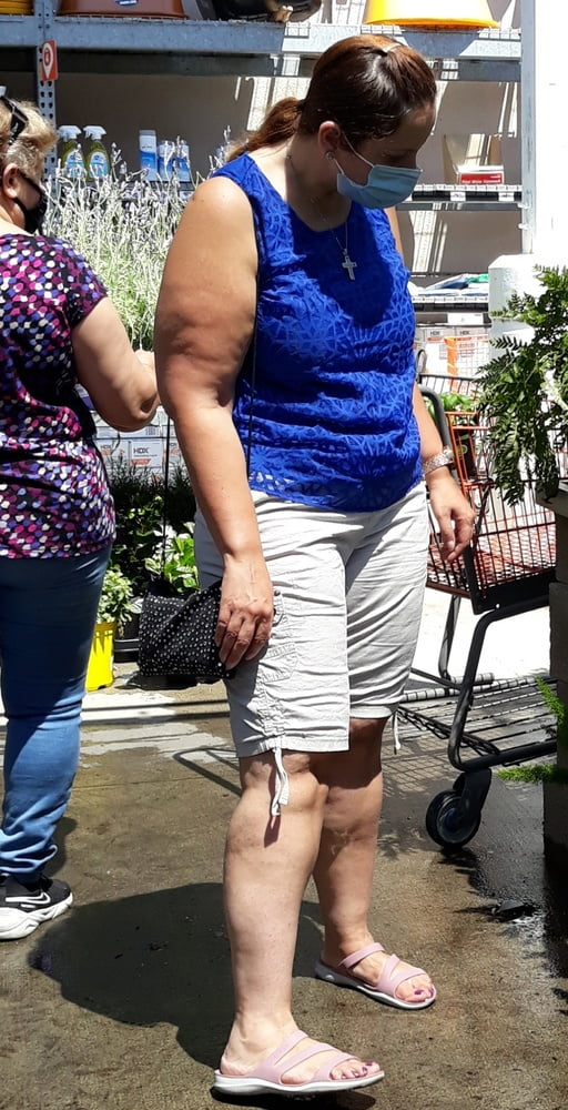 Cellulite Schlampen 2 . sehr fette Arme, schlaffer Arsch, Cellulite Bein
 #87508574