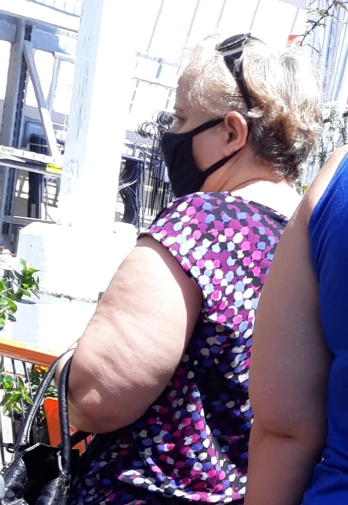 Cellulite Schlampen 2 . sehr fette Arme, schlaffer Arsch, Cellulite Bein
 #87508601