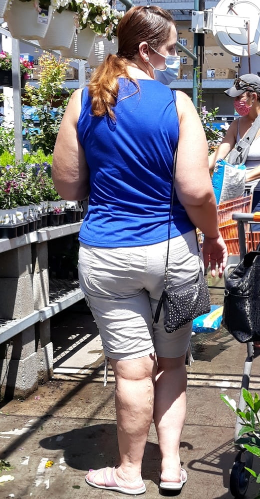 Cellulite Schlampen 2 . sehr fette Arme, schlaffer Arsch, Cellulite Bein
 #87508604