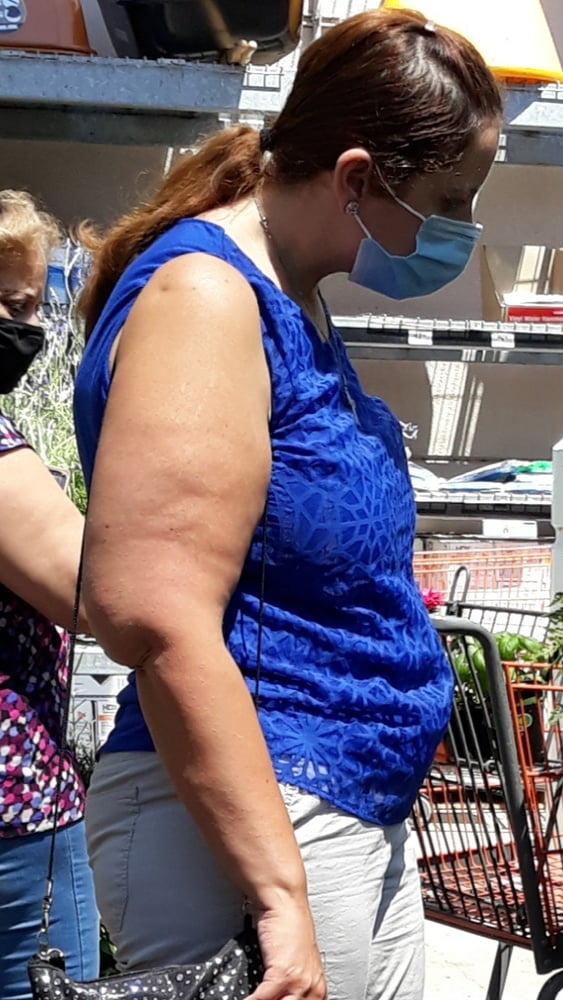 Cellulite Schlampen 2 . sehr fette Arme, schlaffer Arsch, Cellulite Bein
 #87508613