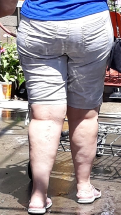 Cellulite Schlampen 2 . sehr fette Arme, schlaffer Arsch, Cellulite Bein
 #87508619