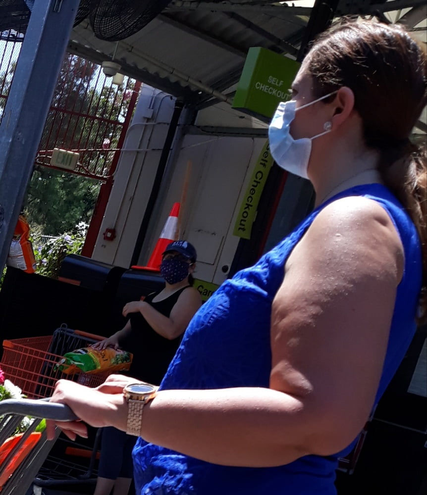 Cellulite Schlampen 2 . sehr fette Arme, schlaffer Arsch, Cellulite Bein
 #87508645