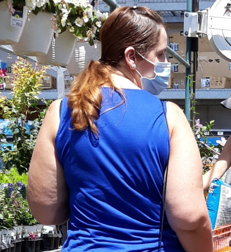 Cellulite Schlampen 2 . sehr fette Arme, schlaffer Arsch, Cellulite Bein
 #87508656