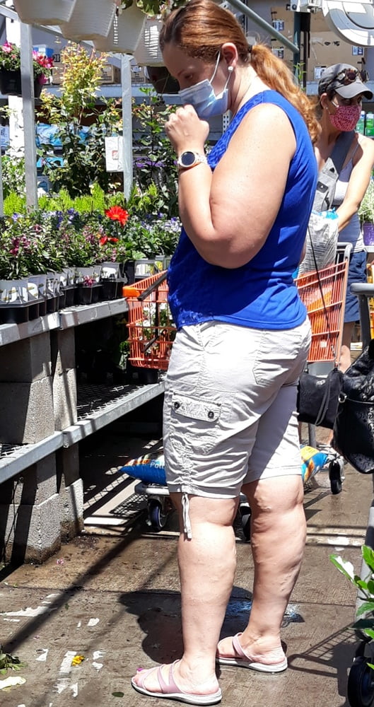 Cellulite Schlampen 2 . sehr fette Arme, schlaffer Arsch, Cellulite Bein
 #87508665