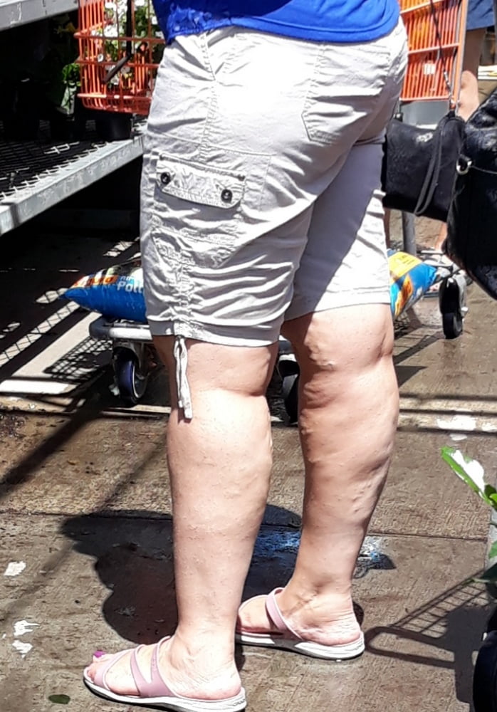 Cellulite Schlampen 2 . sehr fette Arme, schlaffer Arsch, Cellulite Bein
 #87508669