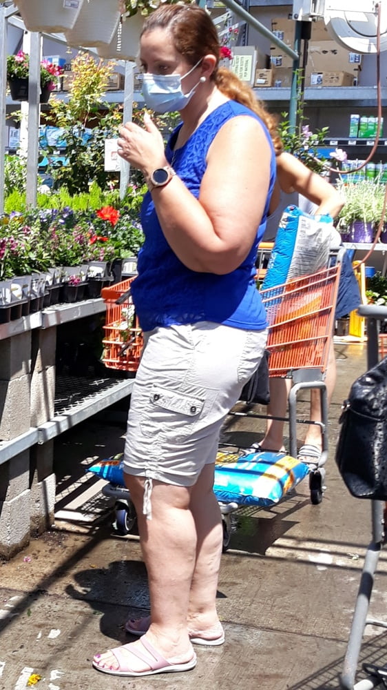 Cellulite Schlampen 2 . sehr fette Arme, schlaffer Arsch, Cellulite Bein
 #87508683