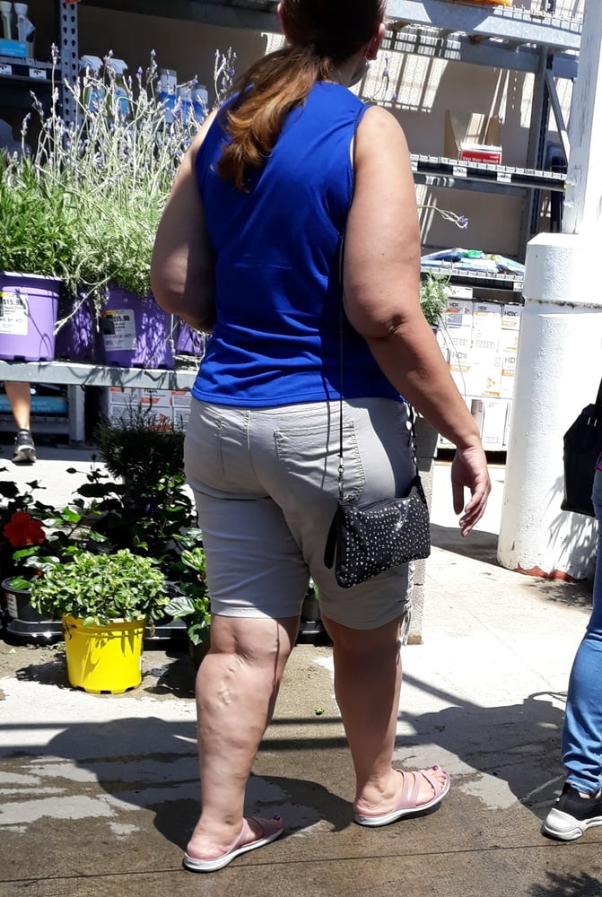 Cellulite Schlampen 2 . sehr fette Arme, schlaffer Arsch, Cellulite Bein
 #87508696