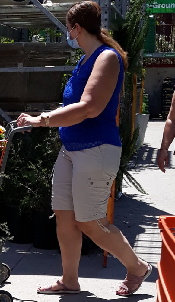 Cellulite Schlampen 2 . sehr fette Arme, schlaffer Arsch, Cellulite Bein
 #87508702