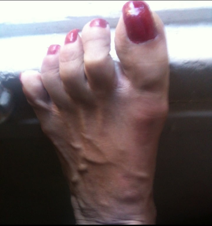 red toenails mix (older, dirty, toe ring, sandals mixed). #106916257